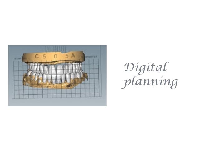 Digital planning